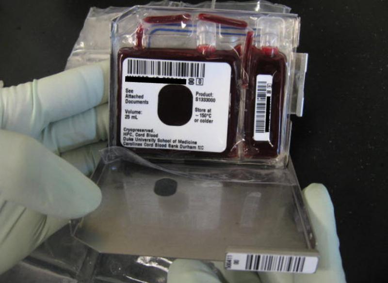 Medical Terminology Quiz cord blood 5