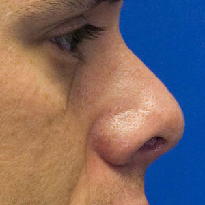 Can You Beat Your Friends in This “Jeopardy!” Quiz? What is a nose?