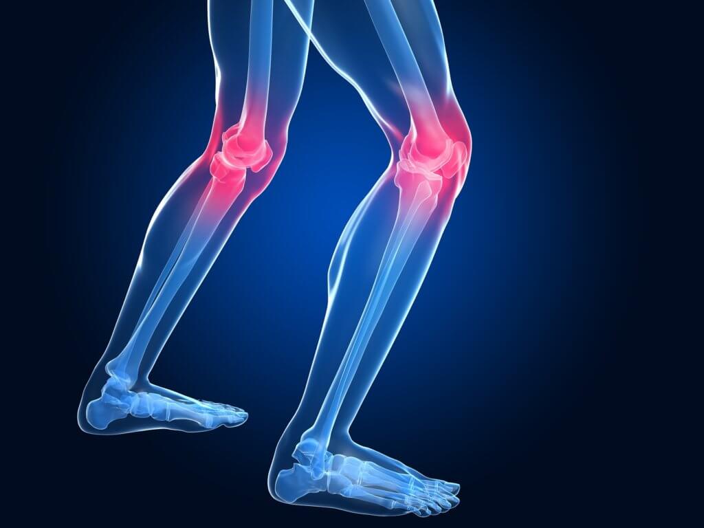 How Close to 20/20 Can You Score on This General Knowledge Quiz? Arthritis Rheumatism knee patella kneecap inflammation