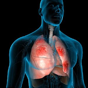 If You Can Ace This Quiz, You’re a Master of General Knowledge Pneumonia