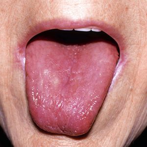 Are You Better at Trivia Than Everyone Else? Tongue