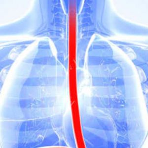 If You Get 12 Things Right On This Quiz, You Should Be Doctor Esophagus
