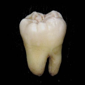 Are You Smarter Than an Elementary School Student? Molars