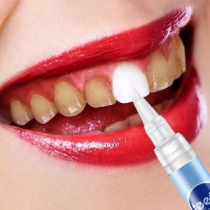 🦷 If You Score 12/15 on This Quiz, You Must Be a Dentist Teeth whitening