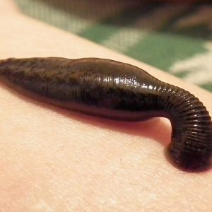 How Long Would You Survive in the Middle Ages? Attach leeches to the wound
