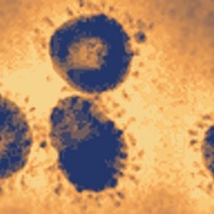 Only People With High Intelligence Can Pass This Random Knowledge Quiz Severe acute respiratory syndrome