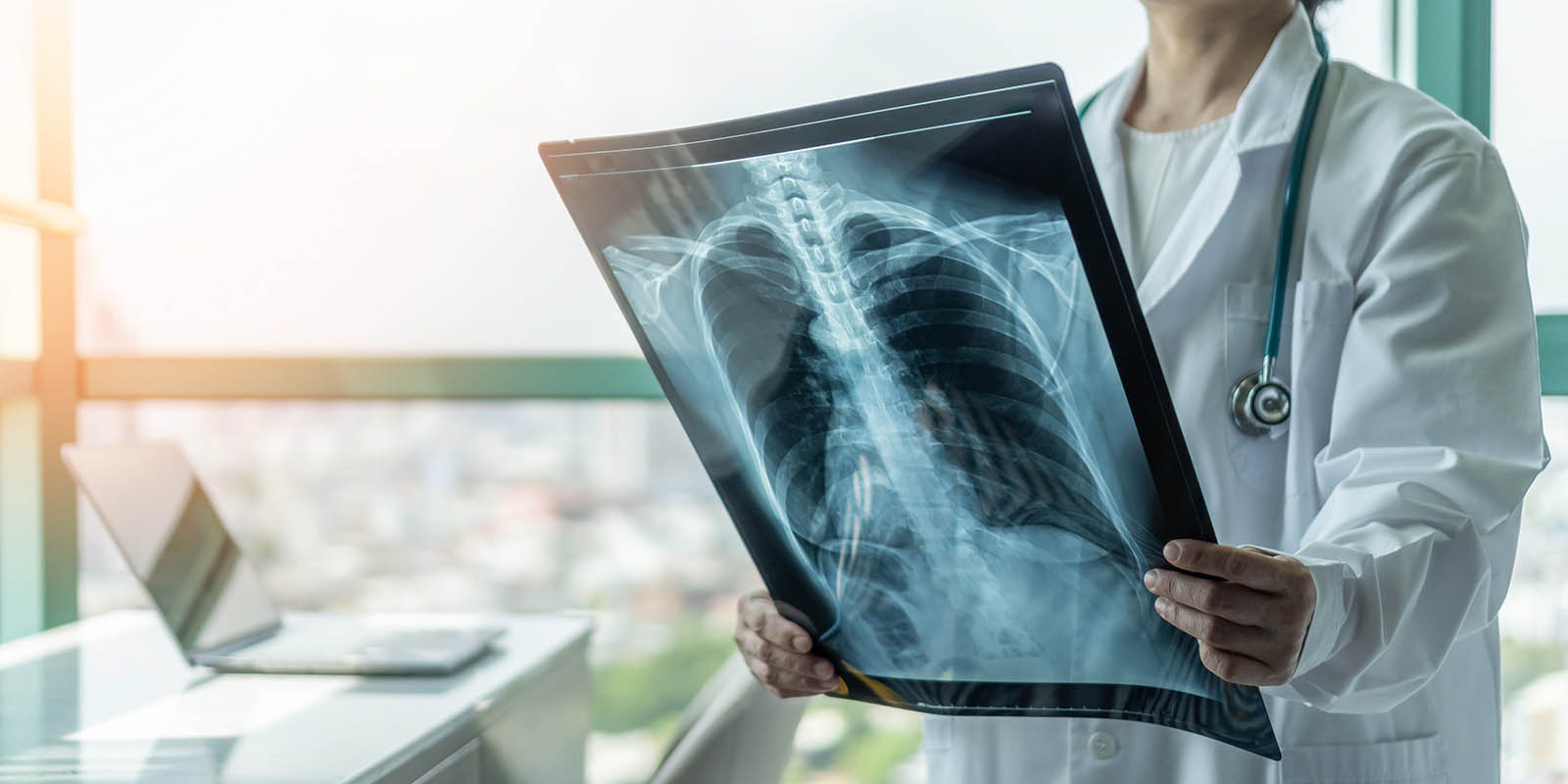 X Trivia Quiz Doctor Holding An X Ray