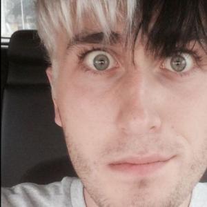 You Have High IQ If You Can Correctly Answer 12 Of Logi… Quiz The boy has both white and black hair