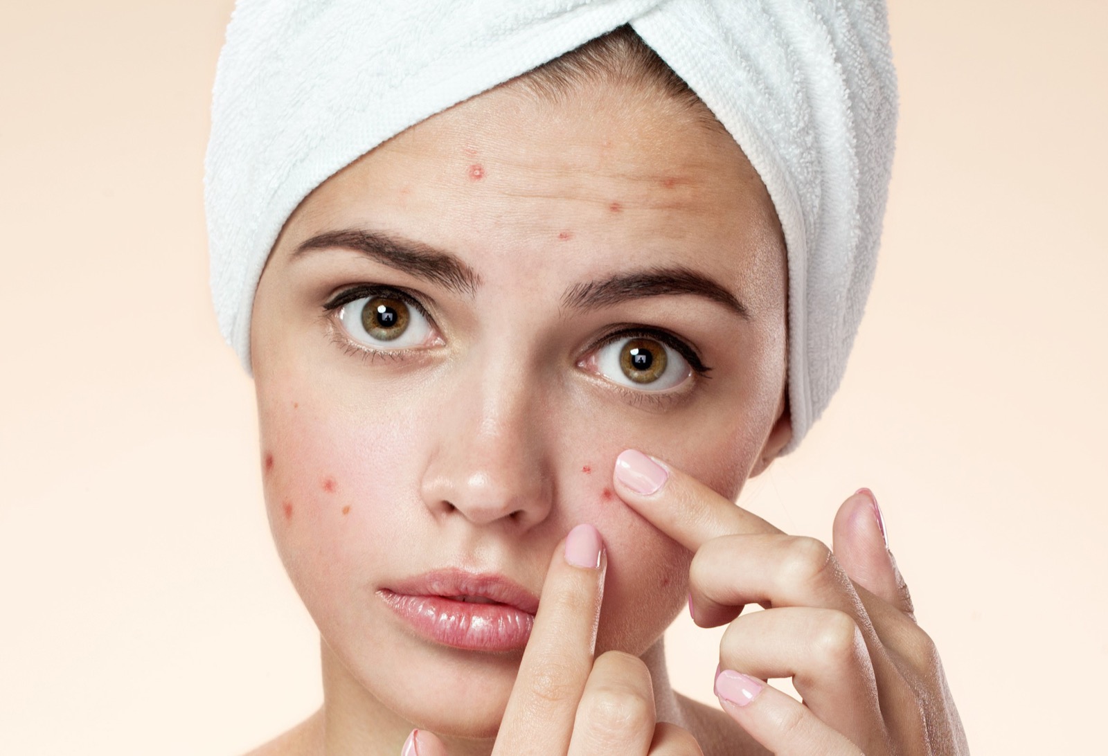 If You Have Done 50% Or More of These Things, I Regret to Inform You That You Are Gross 🤮 Acne pimple skincare beauty