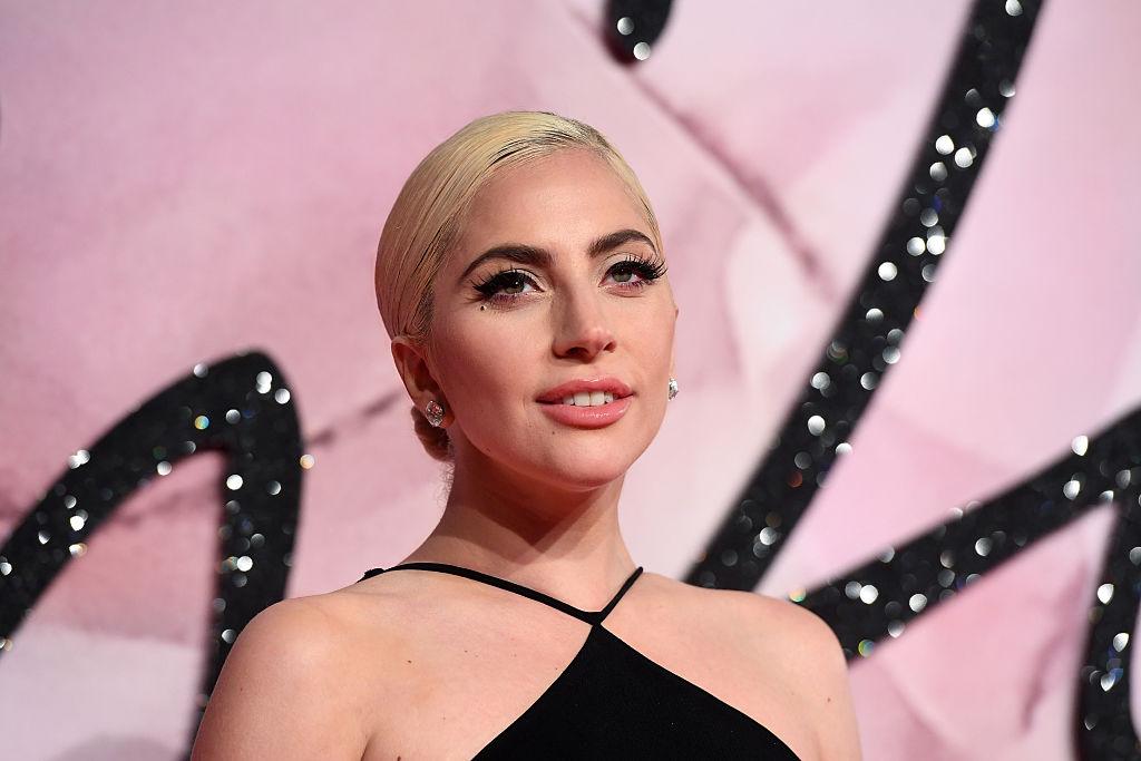 Are You A Black Cat Or A Golden Retriever? Quiz Lady Gaga