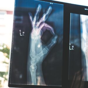 It Happened In May Quiz Discovery of X-rays