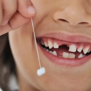 Christmas Trivia Chain Quiz The Tooth Fairy